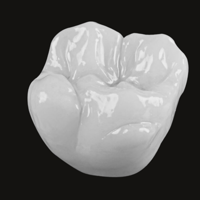 Porcelain Dental Crown