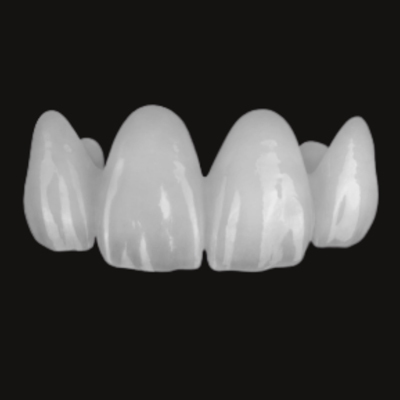 Porcelain dental bridge