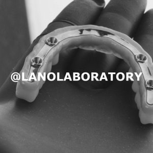 Lano Laboratory