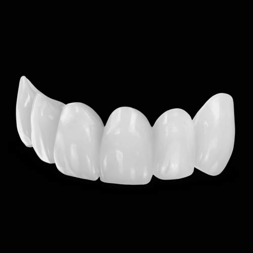 PMMA Provisional Restorations for Immediate Function and Esthetics